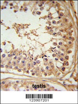 FBXL5 Antibody