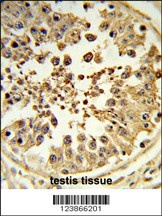 DIAPH2 Antibody