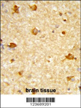 DIRAS1 Antibody