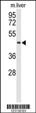 CHIA Antibody
