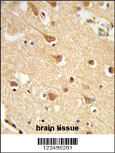 ND2 Antibody