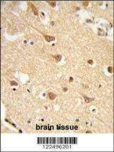 MT-ND2 Antibody