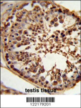 CSPP1 Antibody