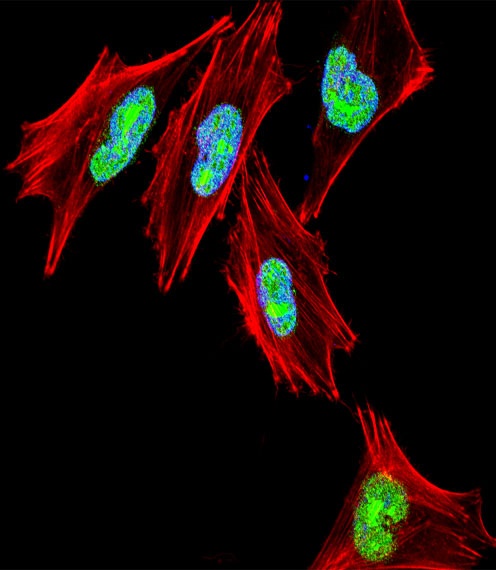 TBX1 Antibody