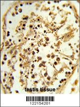 TBX1 Antibody