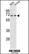 CROT Antibody