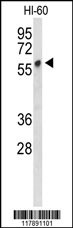 PLVAP Antibody