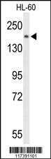 PLCB1 Antibody