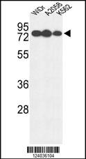 GUSB Antibody