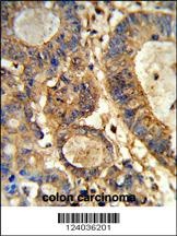 GUSB Antibody