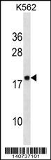 RPLP2 Antibody