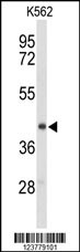 ENTPD2 Antibody