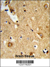 ENTPD2 Antibody