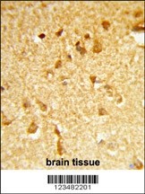 DDX17 Antibody