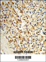 PCAT1 Antibody