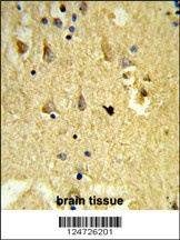 SH3BGRL3 Antibody