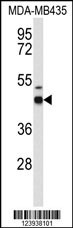 GABRD Antibody