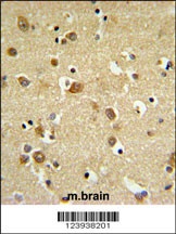GABRD Antibody