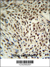 SNRPD3 Antibody