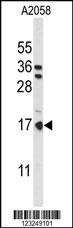 PTMS Antibody