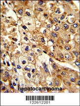 ATP1B2 Antibody