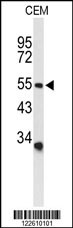 ASIC1 Antibody