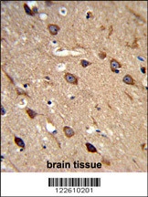 ASIC1 Antibody