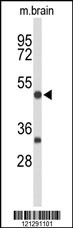 MEF2A Antibody