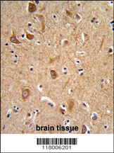 ITGA6 Antibody