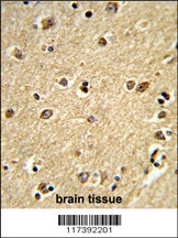 PLCB2 Antibody