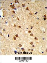 ATXN3 Antibody