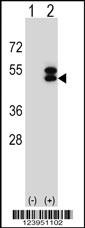 ATXN3 Antibody