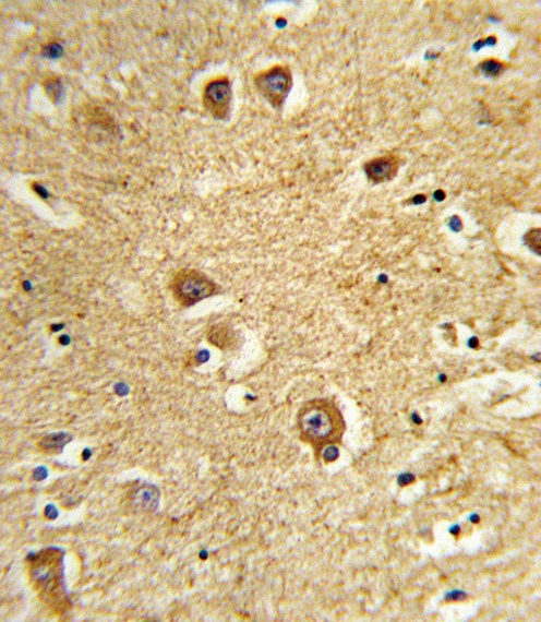 SLC22A6 Antibody