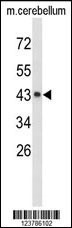 EXTL2 Antibody