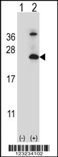 TSPAN6 Antibody