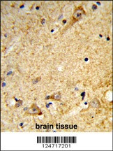 MARVELD2 Antibody