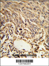 EIF4A2 Antibody