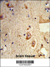 DSTN Antibody