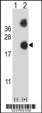 DSTN Antibody