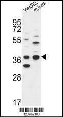 DHRS3 Antibody