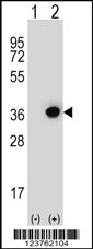 DHRS3 Antibody