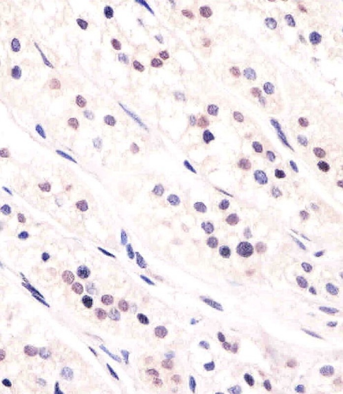 CDC73 Antibody