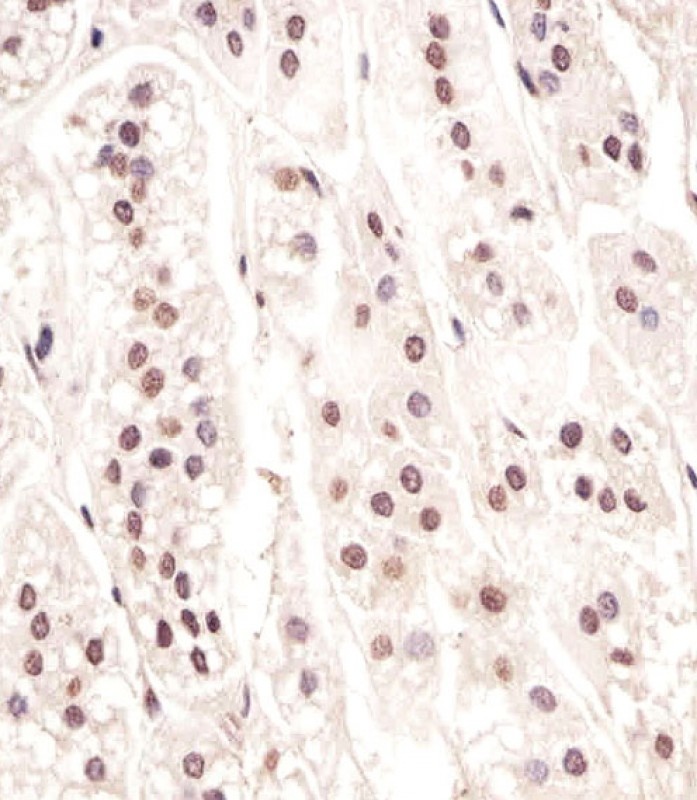 CDC73 Antibody