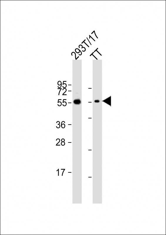 CDC73 Antibody