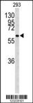 CDC73 Antibody