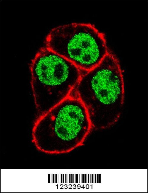 CDC73 Antibody