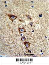 KCNH7 Antibody