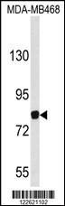 EVI5 Antibody