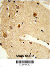 CNDP1 Antibody