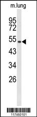 MUTYH Antibody